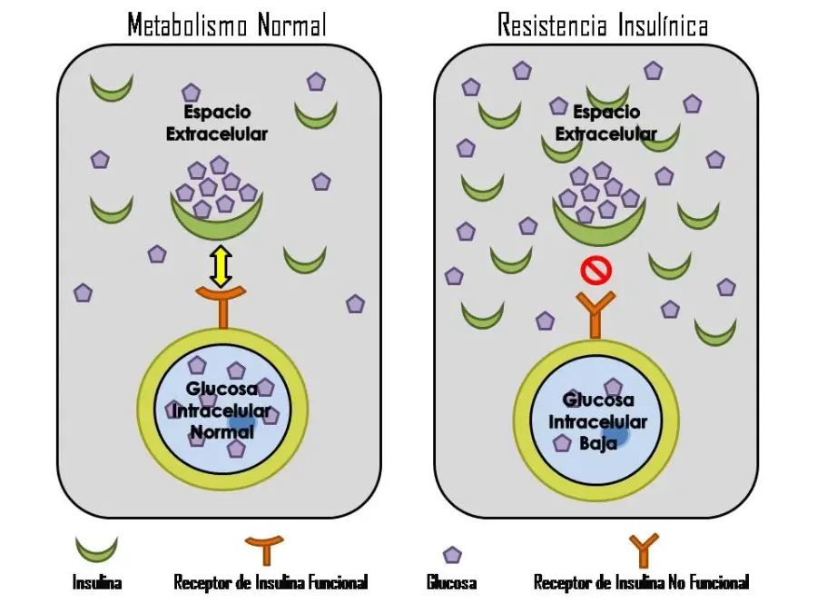 The Insulin resistance card