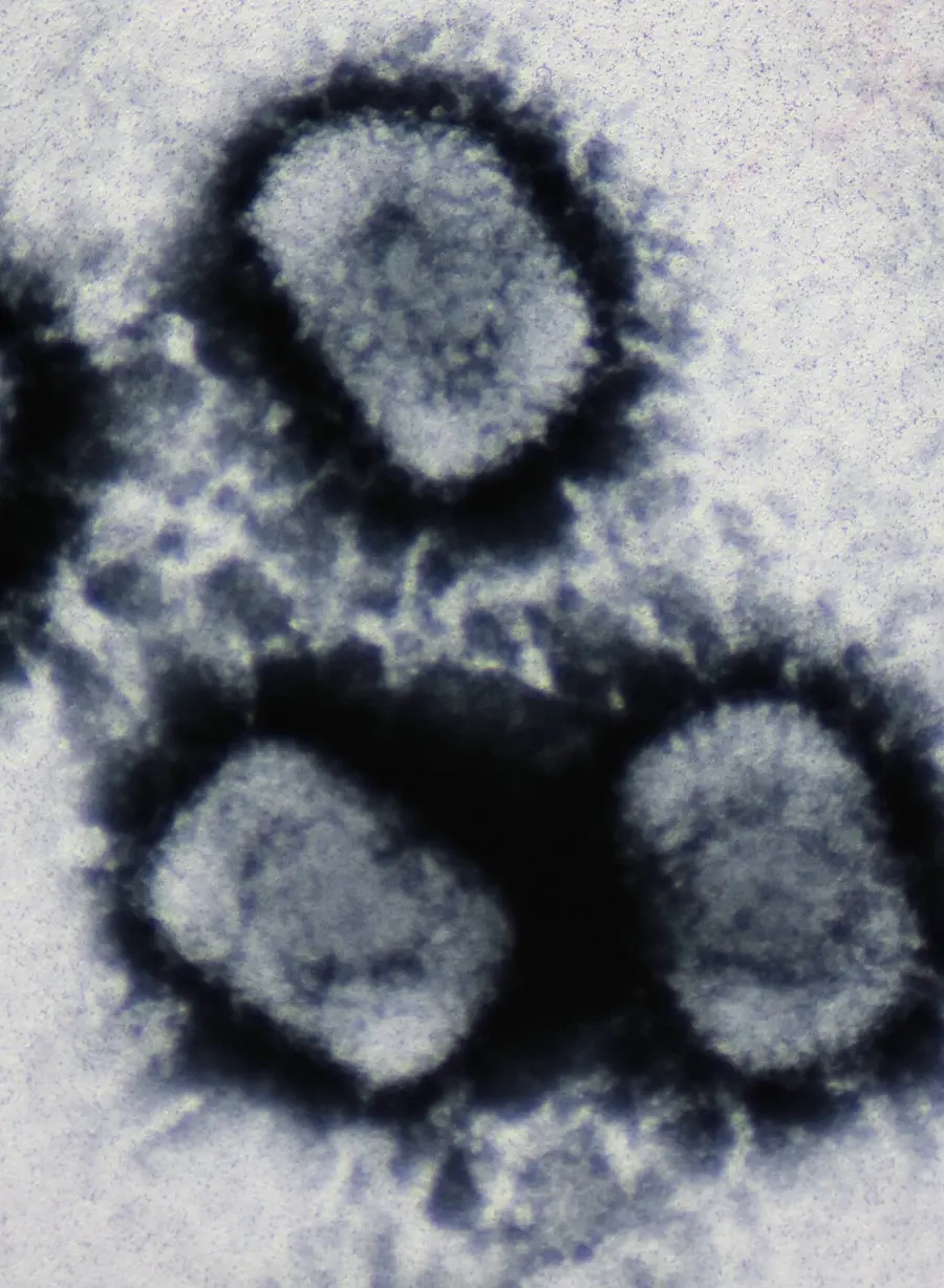 La carte Cowpox