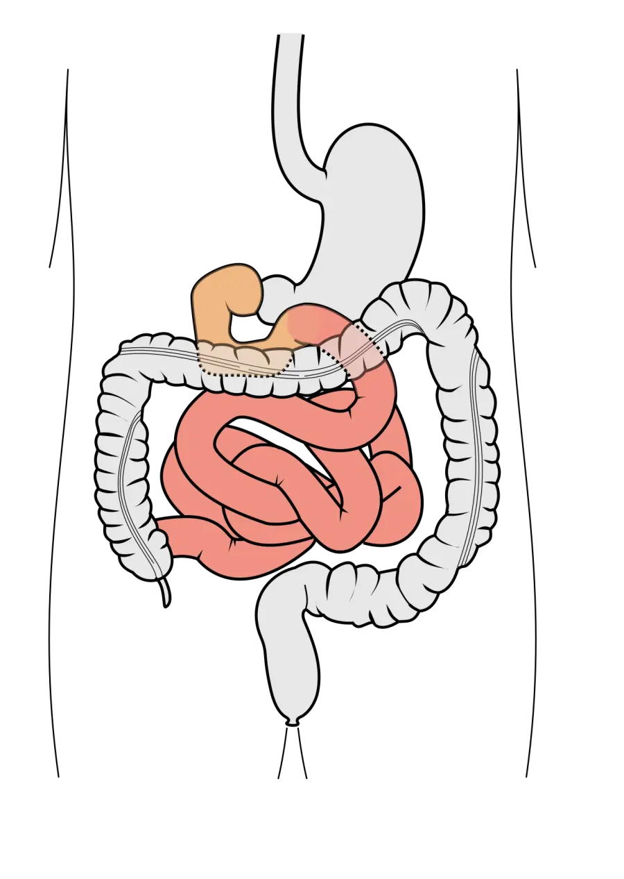 The Small intestine card
