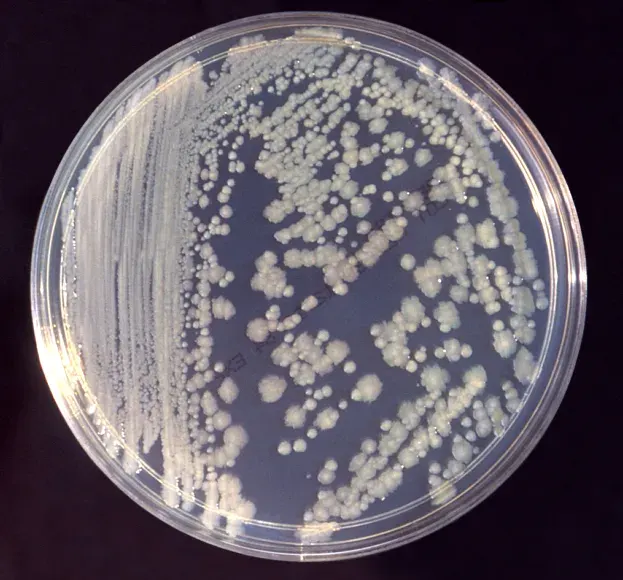The Microbiological culture card
