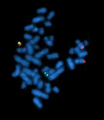 La carte Chromosome de Philadelphie