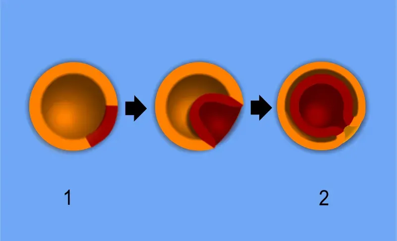 The Gastrulation card