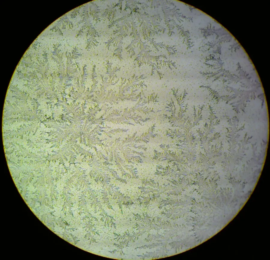 La carte Oligoamnios