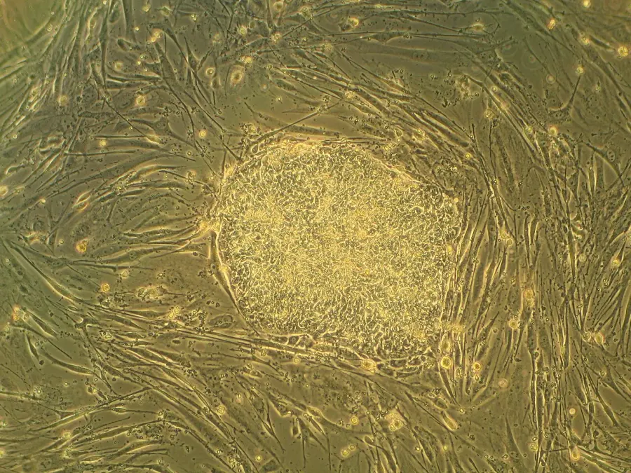La carte Cellule souche embryonnaire