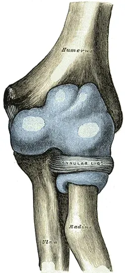 The Pulled elbow card