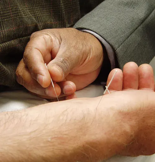 La carte Acupuncture