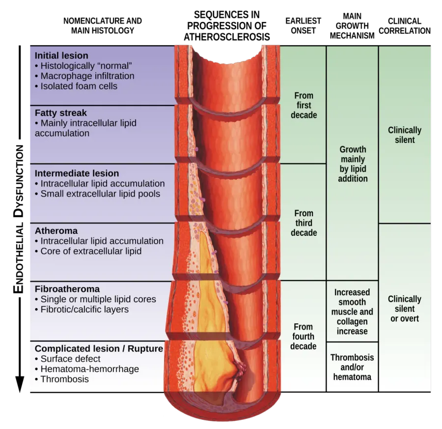 The Atherosclerosis card