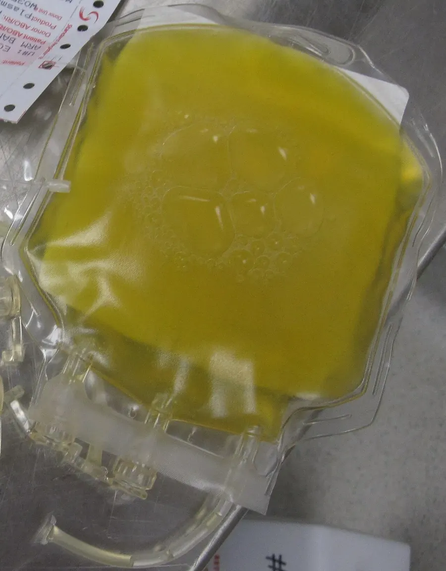 The Fresh frozen plasma card