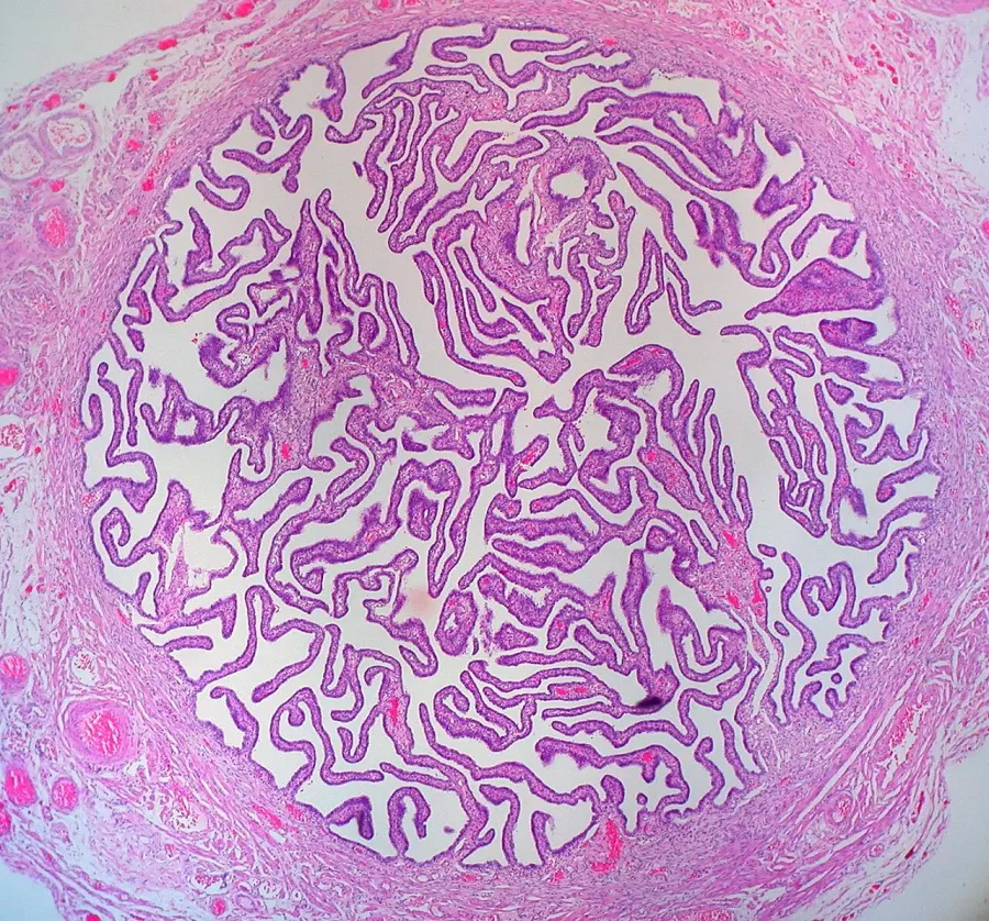 The Fallopian tube card