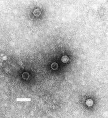 La carte Poliovirus