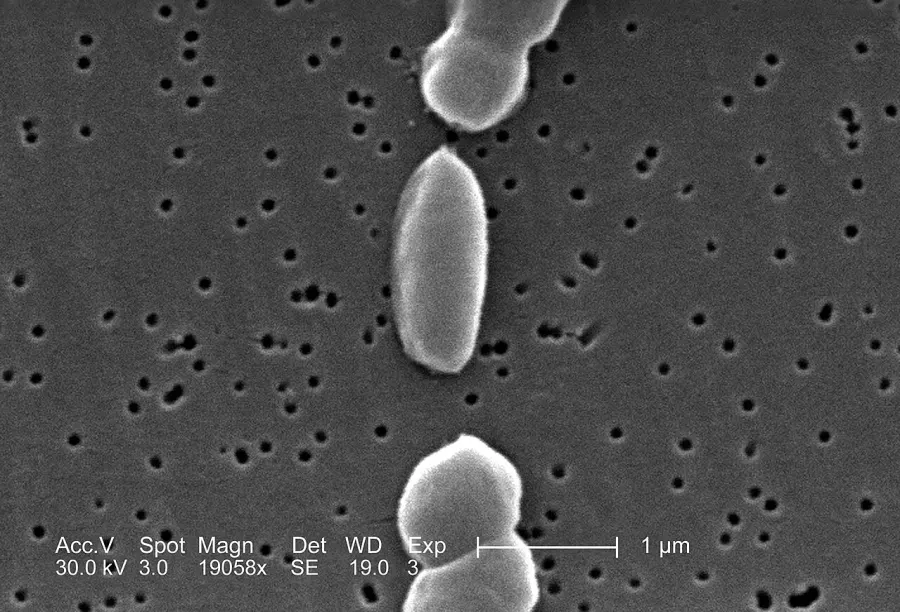 La carte Vibrio parahaemolyticus