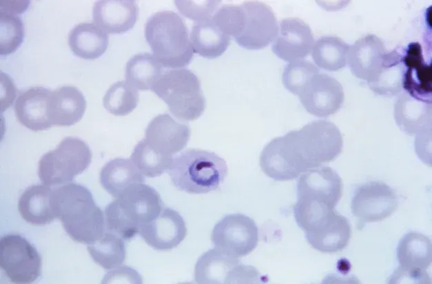 The Plasmodium ovale card