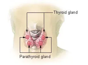 La carte Hyperparathyroïdie