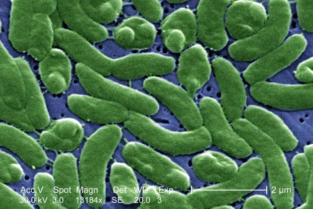 La carte Vibrio vulnificus