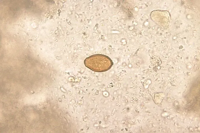 The Heterophyes heterophyes card