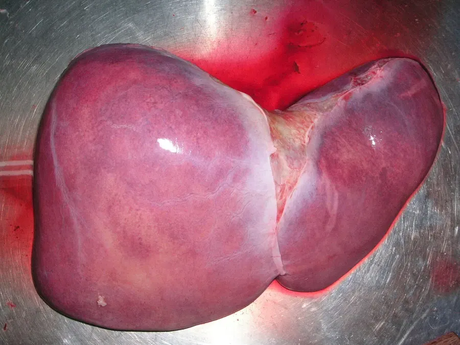 La carte Transplantation hépatique