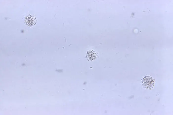 The Ureaplasma urealyticum card
