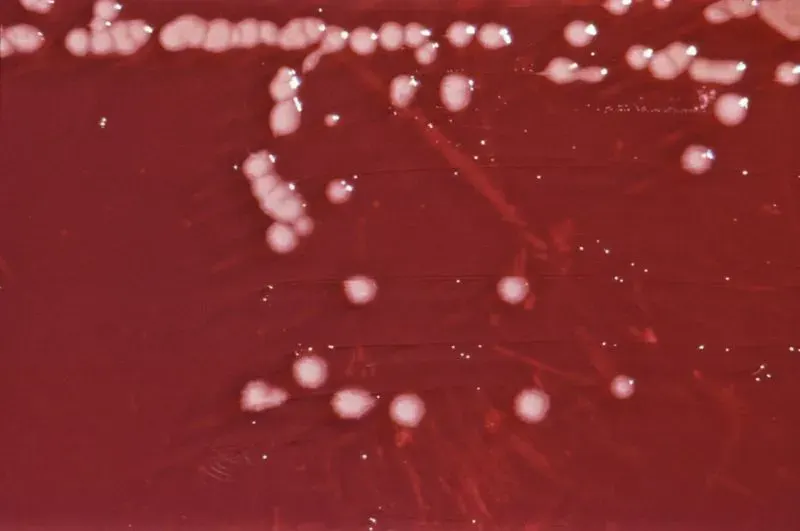 The Pseudomonadaceae card