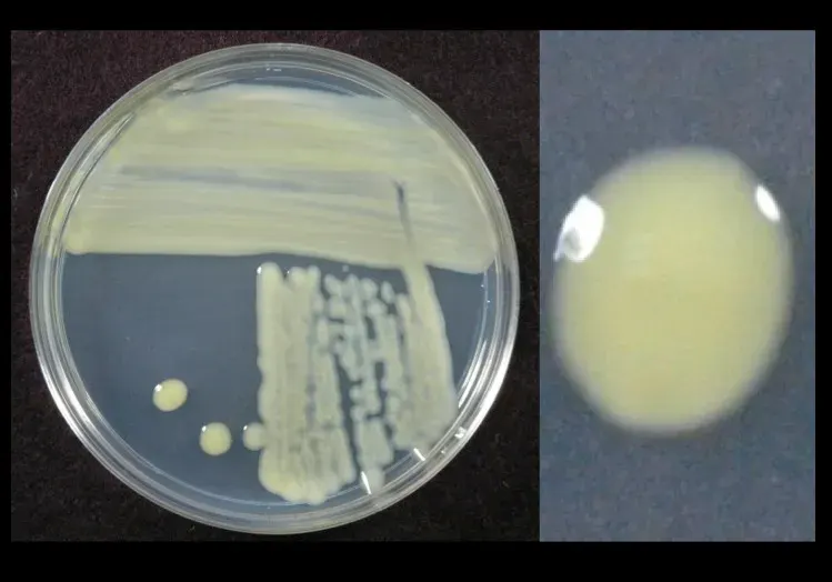 The Xanthomonas card