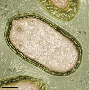 The Pandoravirus card