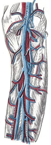 La carte Maladie thromboembolique