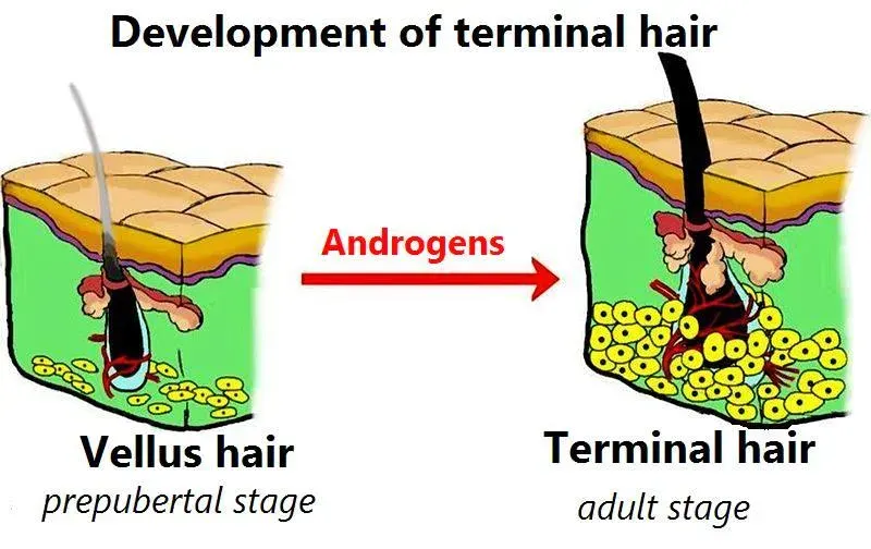 The Vellus hair card