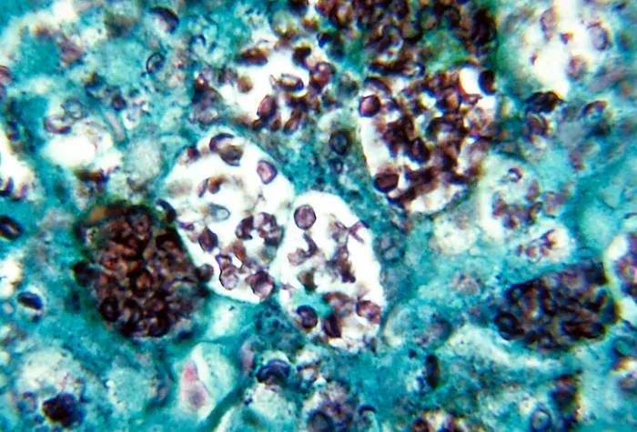 La carte Histoplasma capsulatum
