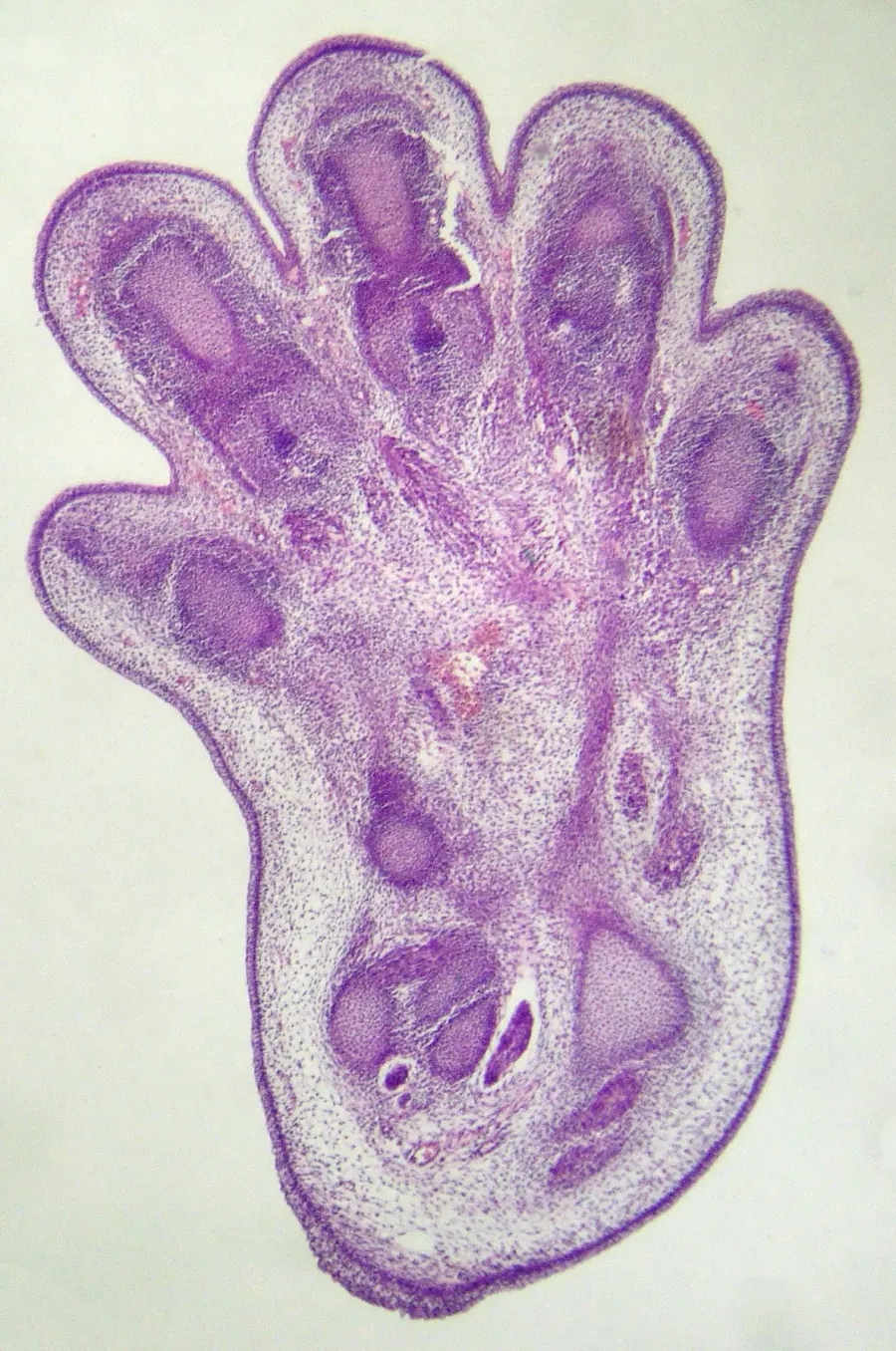 La carte Apoptose