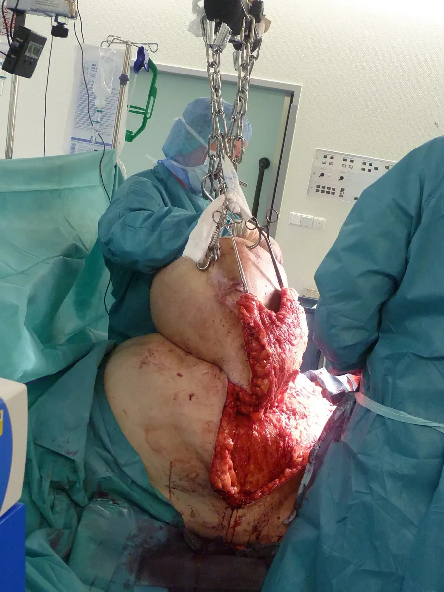 The Bariatrics card