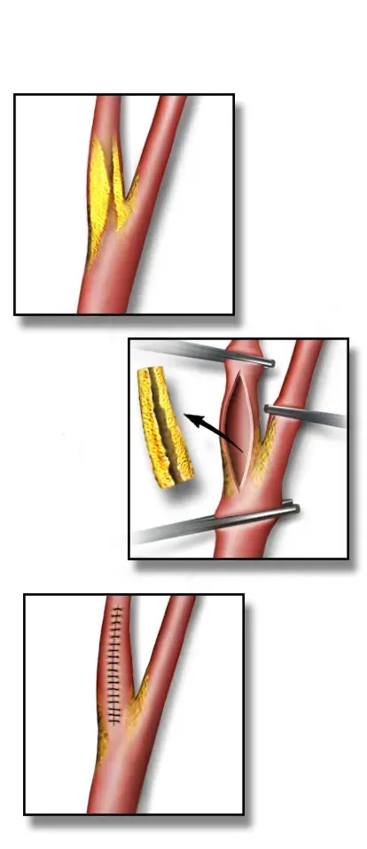 The Vascular surgery card