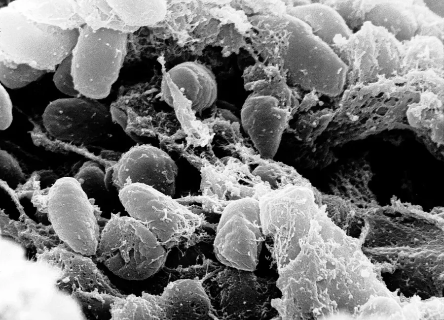 La carte Yersinia pestis