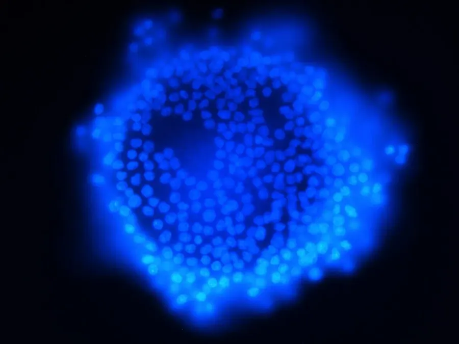 The Granulosa cell card