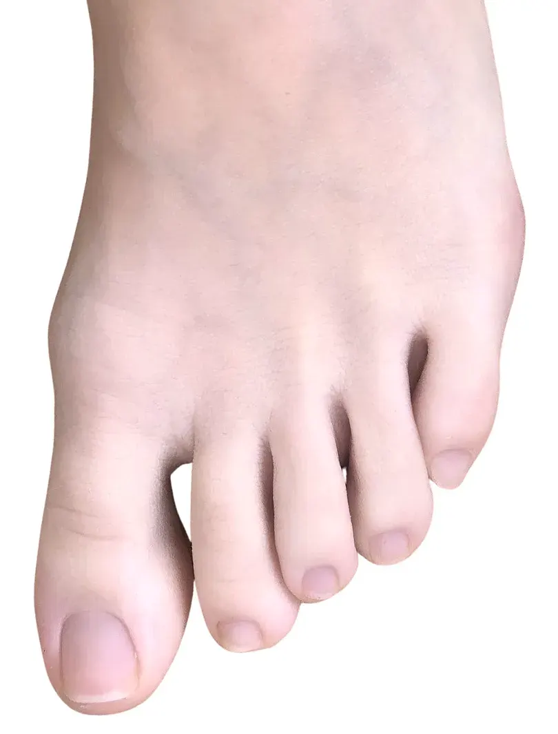 The Toe card