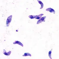 La carte Toxoplasmose