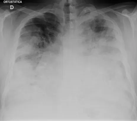 The Legionnaires' disease card