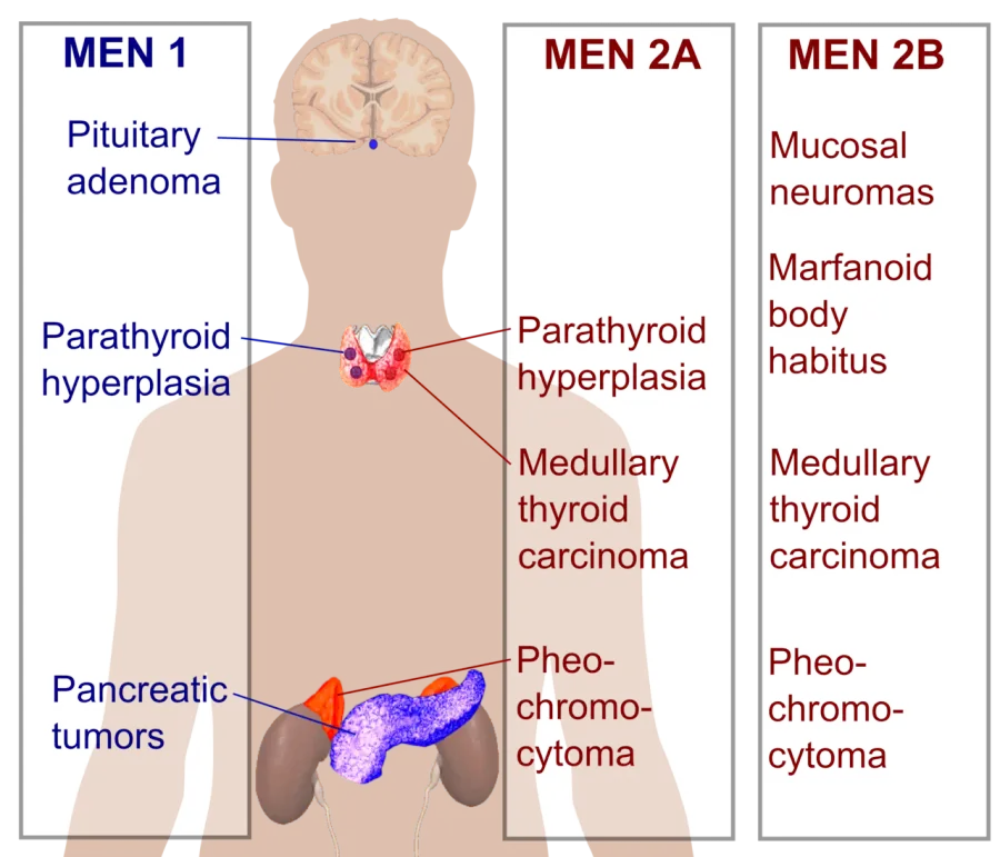 The Multiple endocrine neoplasia card
