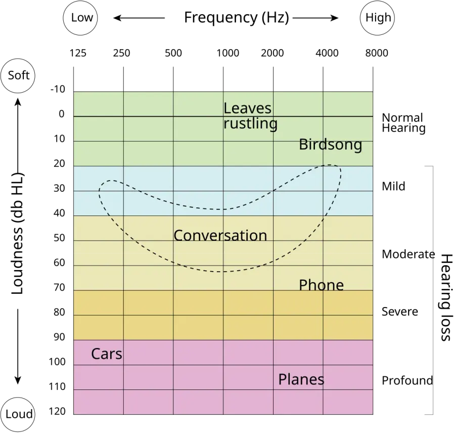 The Hearing loss card