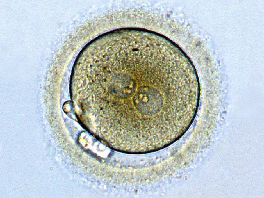 The Zygote card