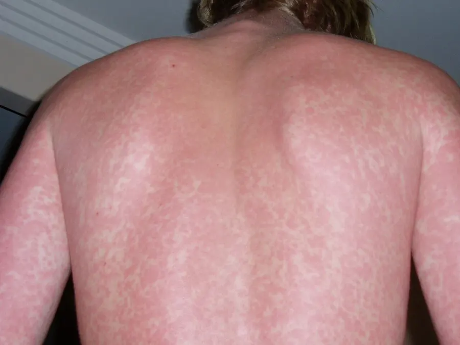 The Dermatology card