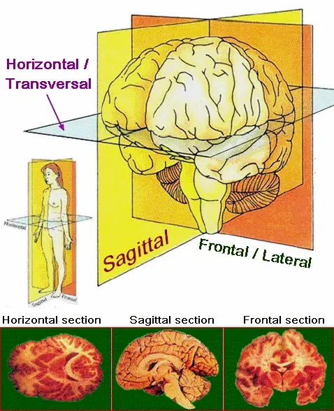 La carte Dégénérescence corticobasale