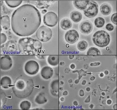 The Blastocystis card