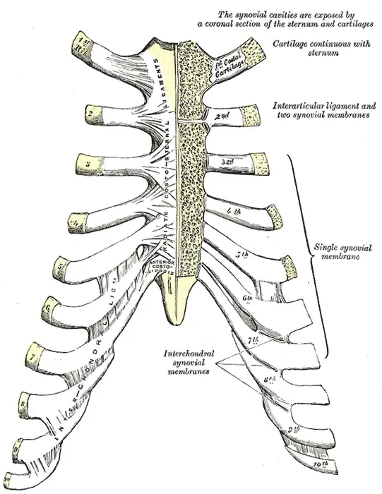 La carte Syndrome de Tietze