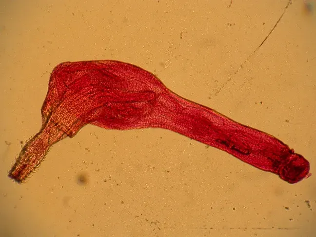 The Acanthocephala card
