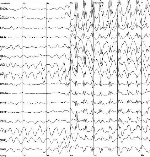 The Electroencephalography card