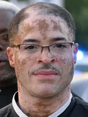 La carte Vitiligo