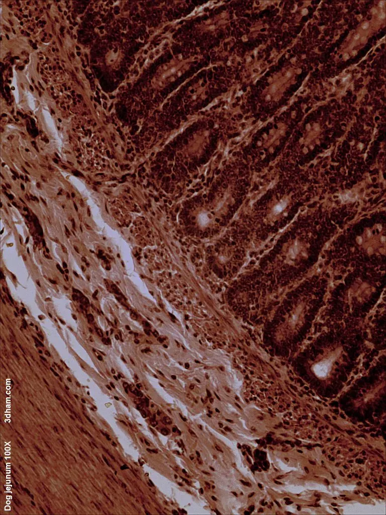 La carte Jéjunum