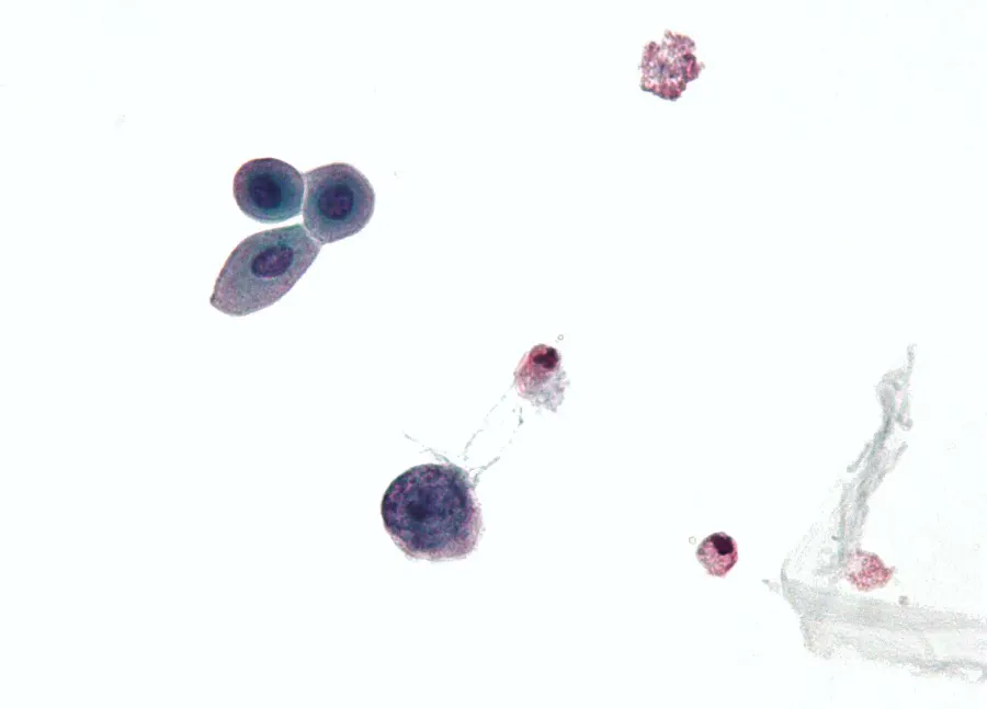 La carte Polyomaviridae