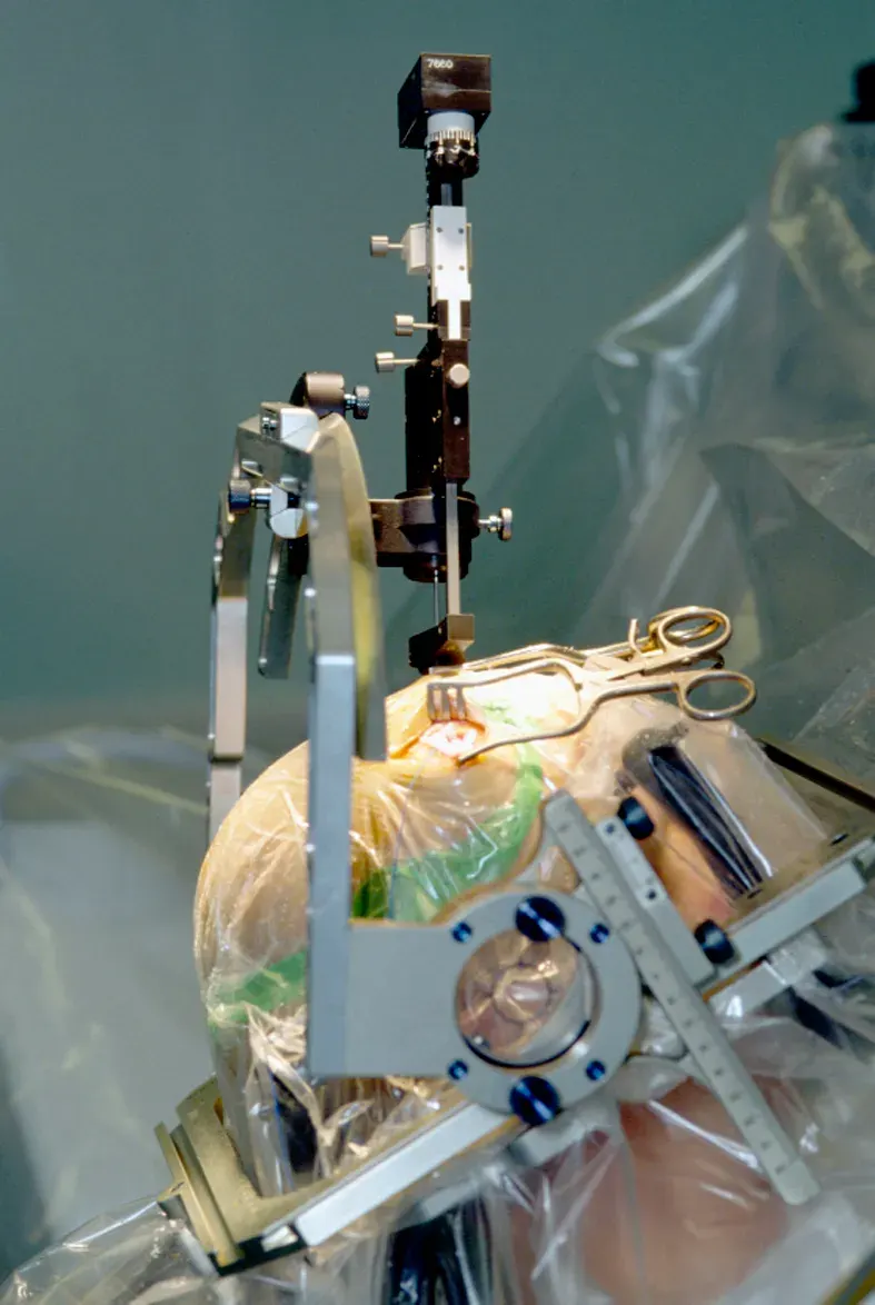 La carte Neurochirurgie