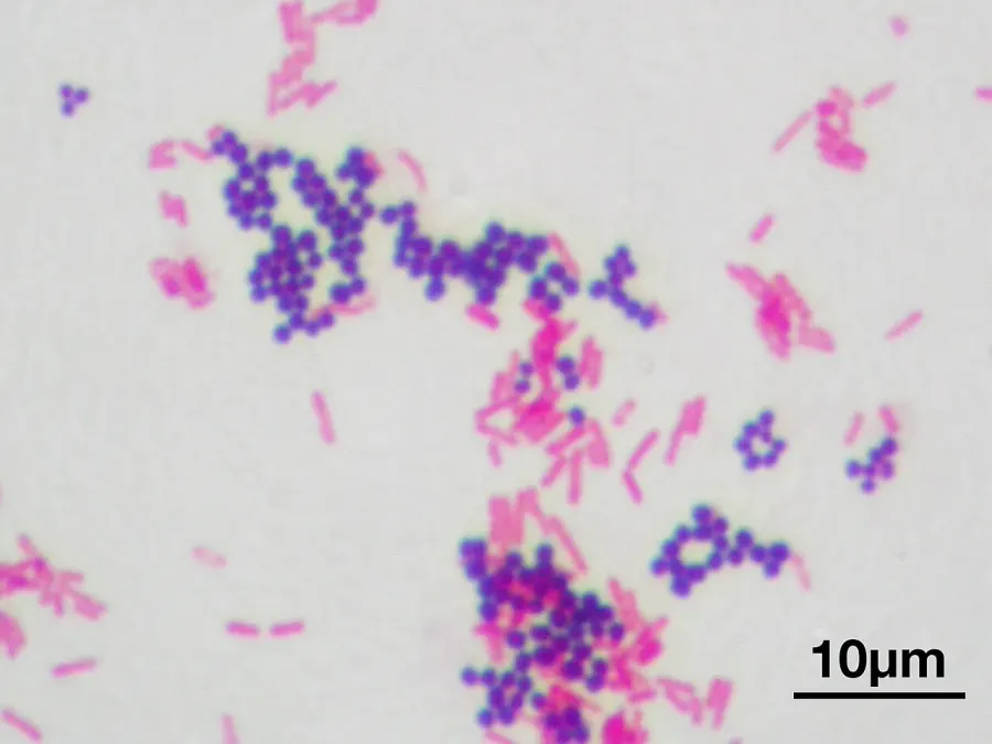 The Gram stain card