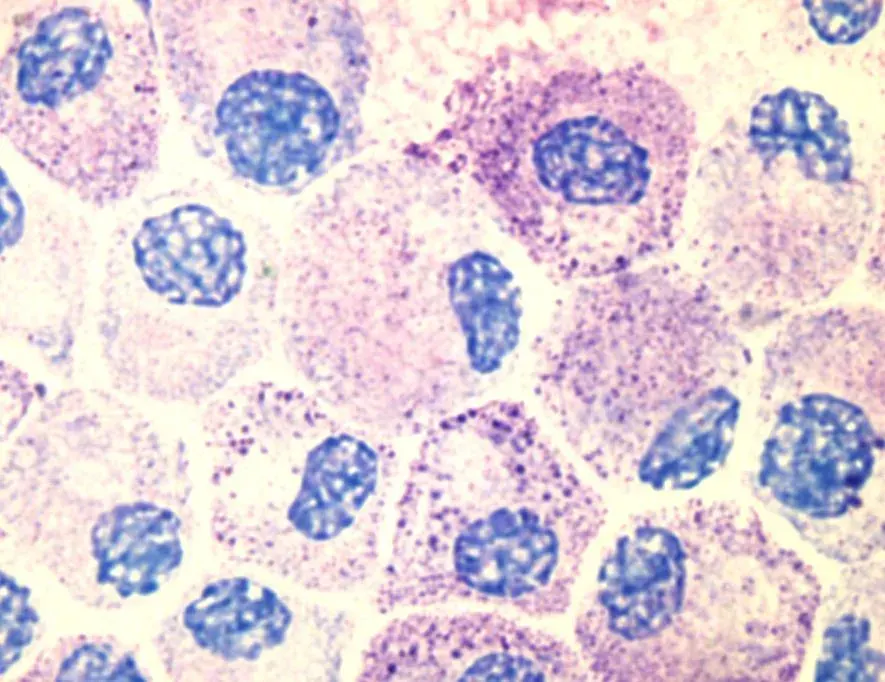 La carte Mastocyte